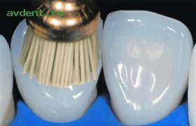 Щеточки OptiShine, 10 шт.KERR Щеточки OptiShine, 10 шт.KERR